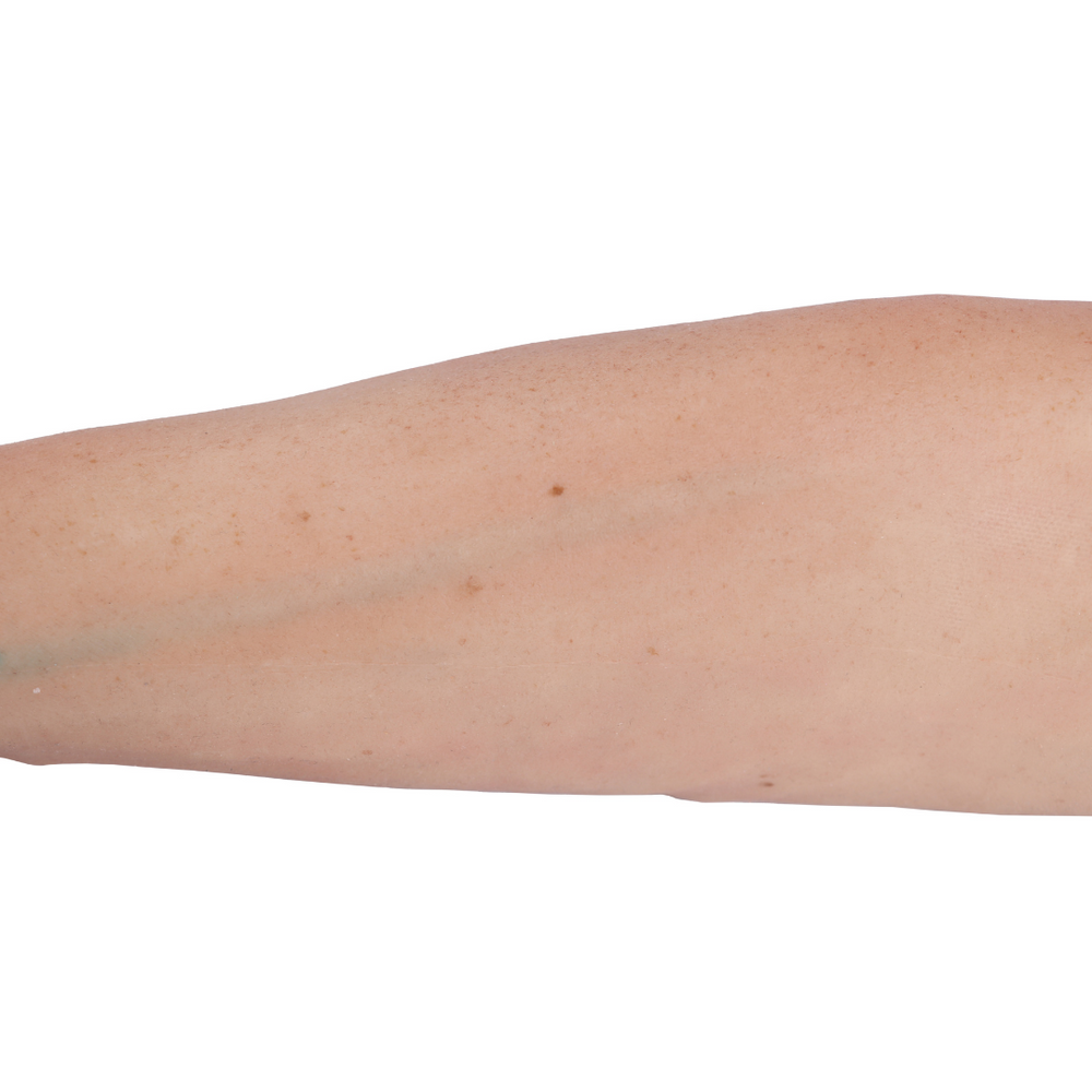 Hyper-Realistic IV Arm Puncture Pete | Light Skin | EZ-7710 | Sim & Skills Ltd