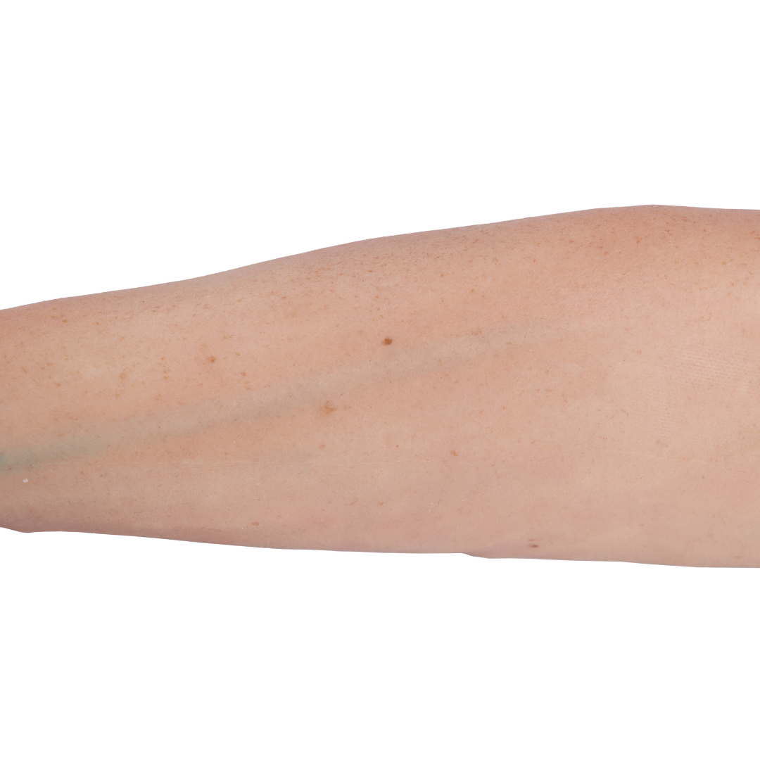 Hyper-Realistic IV Arm Puncture Pete | Light Skin | EZ-7710 | Sim & Skills Ltd