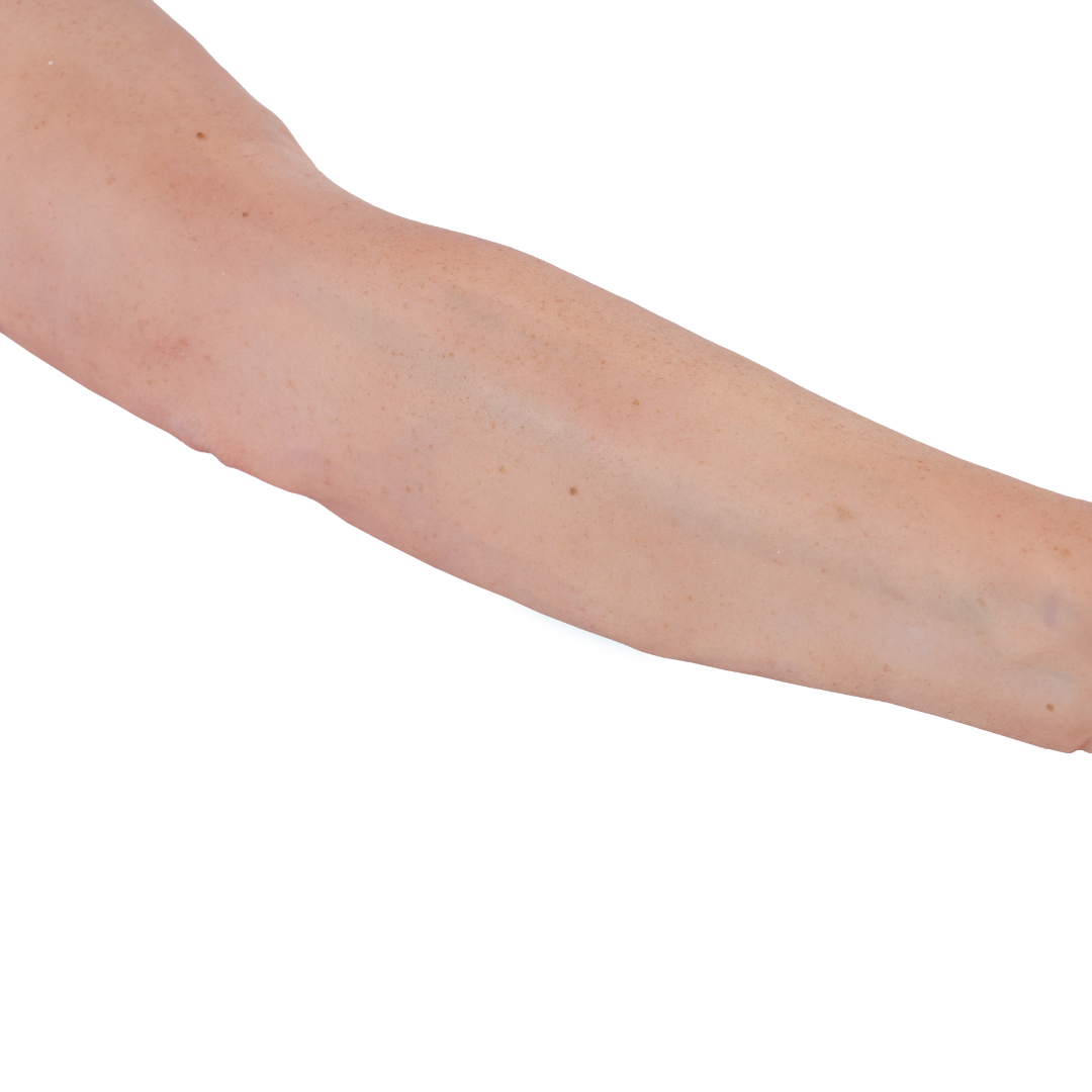 Hyper-Realistic IV Arm Puncture Pete | Light Skin | EZ-7710 | Sim & Skills Ltd