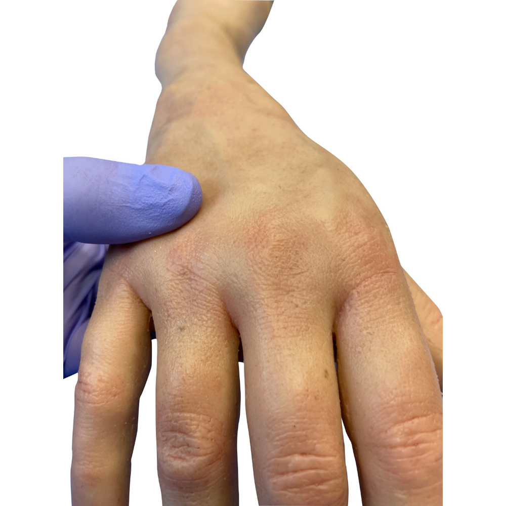Hyper-Realistic IV Arm Puncture Pete | Light Skin | EZ-7710 | Sim & Skills Ltd