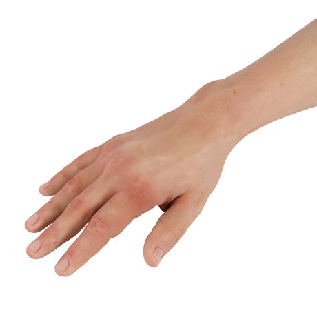 Hyper-Realistic IV Arm Puncture Pete | Light Skin | EZ-7710 | Sim & Skills Ltd