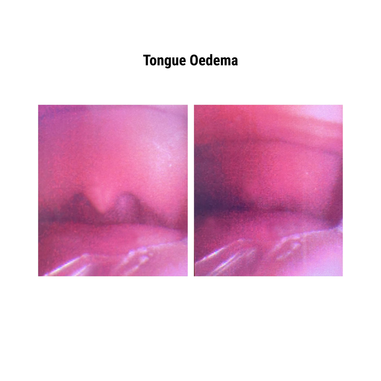 Difficult Airway Management Simulator with Feedback