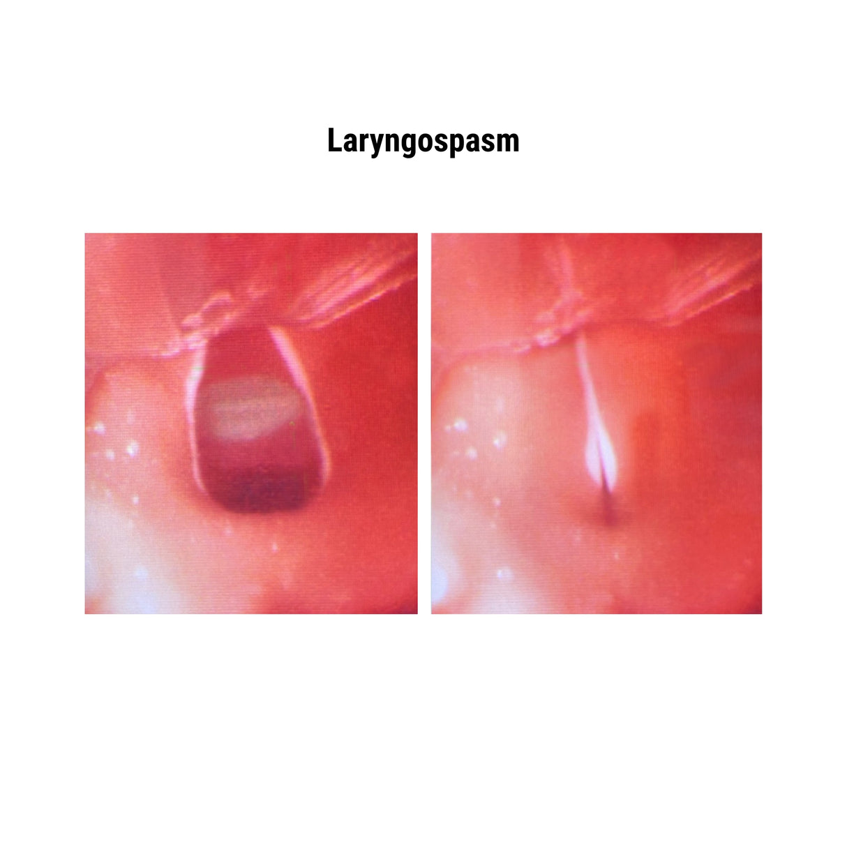 Difficult Airway Management Simulator with Feedback