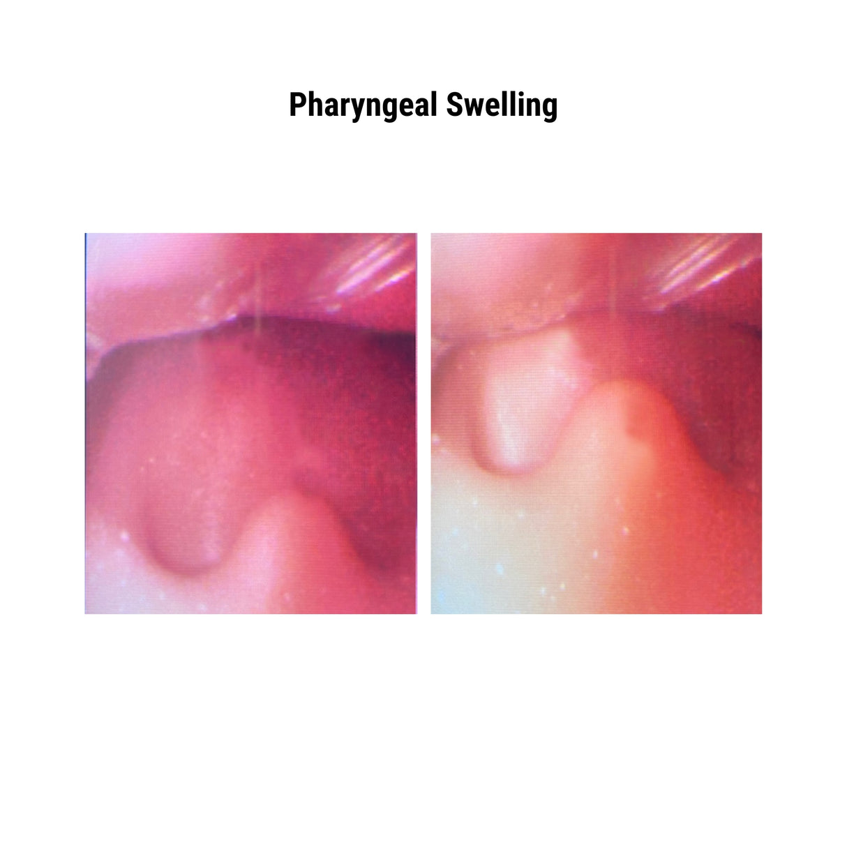 Difficult Airway Management Simulator with Feedback