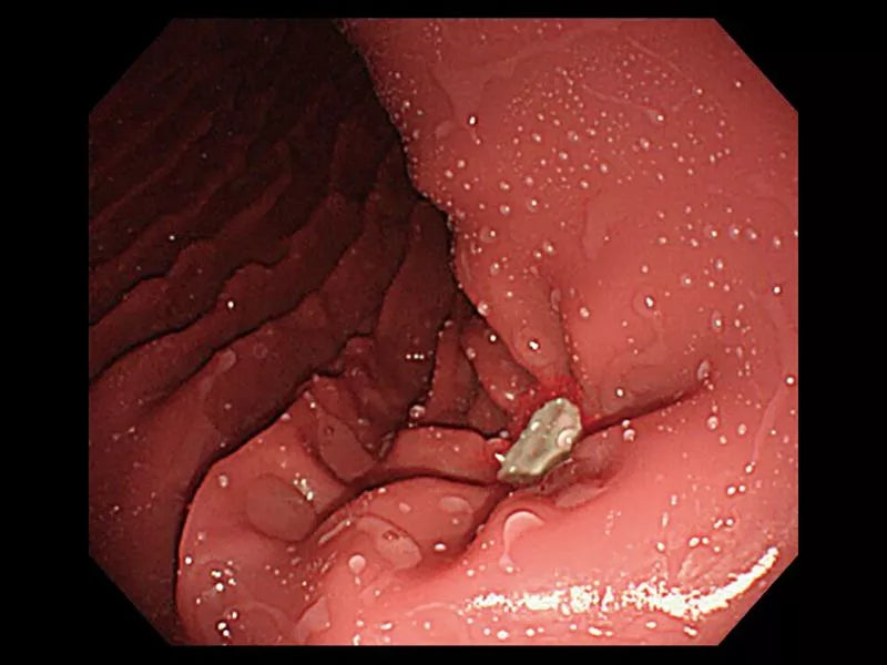 OGD (OesophagoGastroDuodenoscopy) Simulator