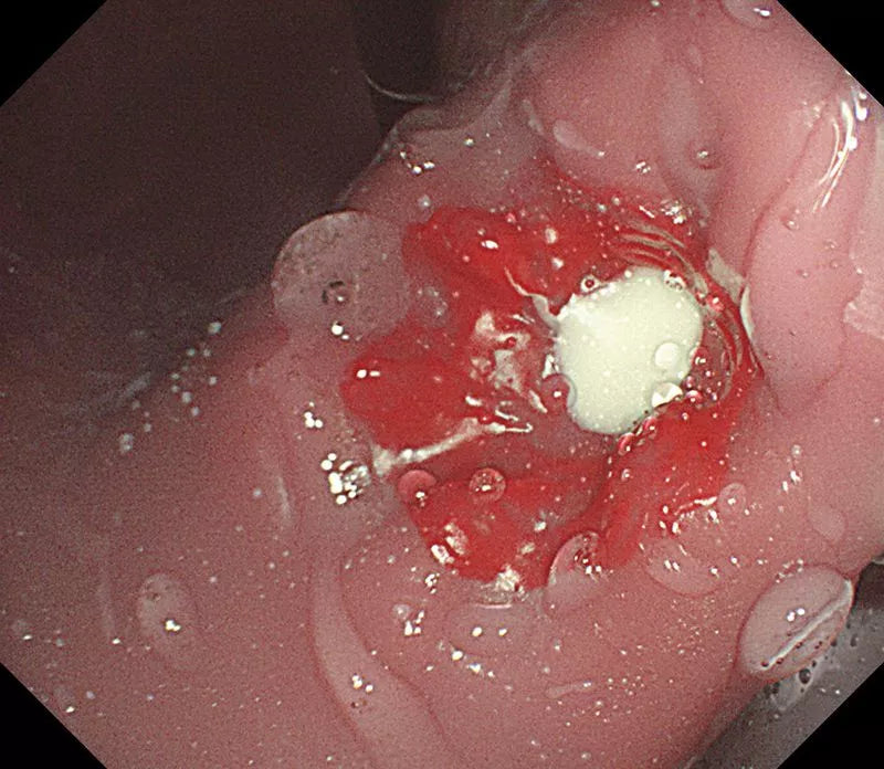 OGD (OesophagoGastroDuodenoscopy) Simulator