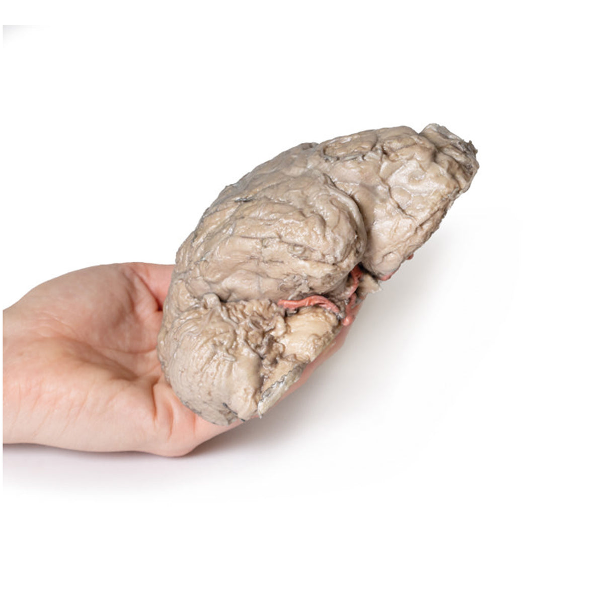 Brain Hemisection | EZ-MP1102 | Sim & Skills Ltd