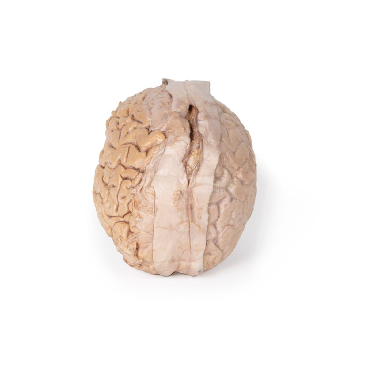 Brain (Cerebrum) | EZ-MP1103 | Sim & Skills Ltd