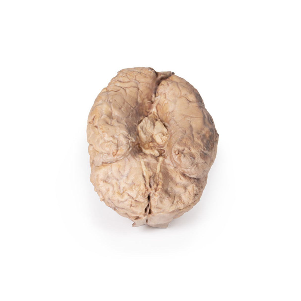 Brain (Cerebrum) | EZ-MP1103 | Sim & Skills Ltd