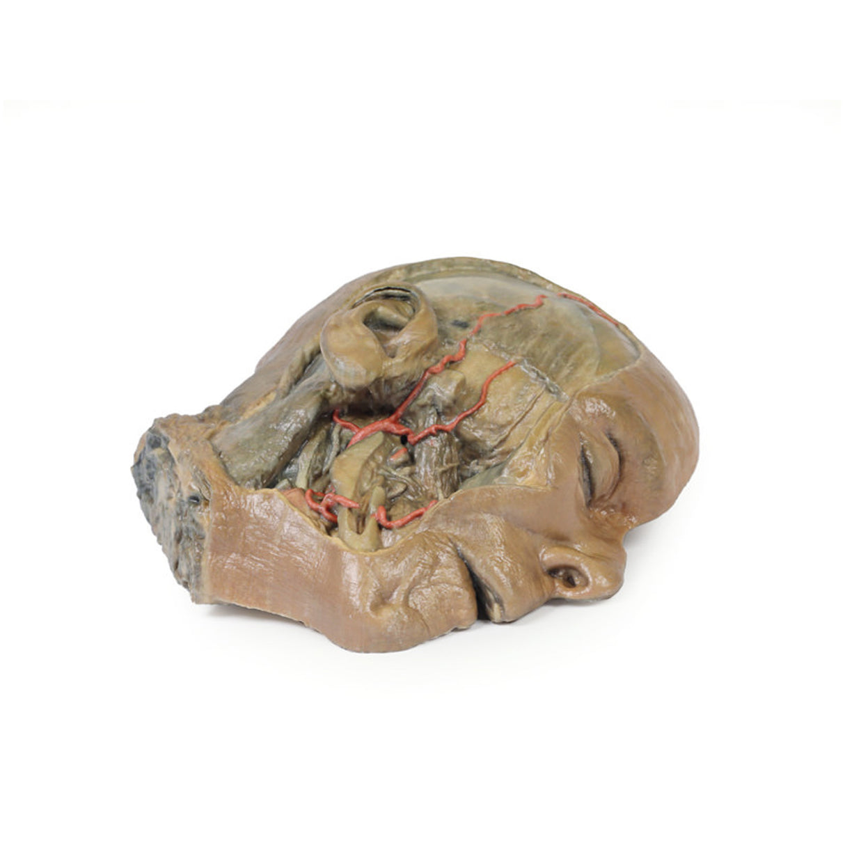 Sagittal Section of head with infratemporal Fossa Dissection | EZ-MP1104 | SIm & Skills Ltd