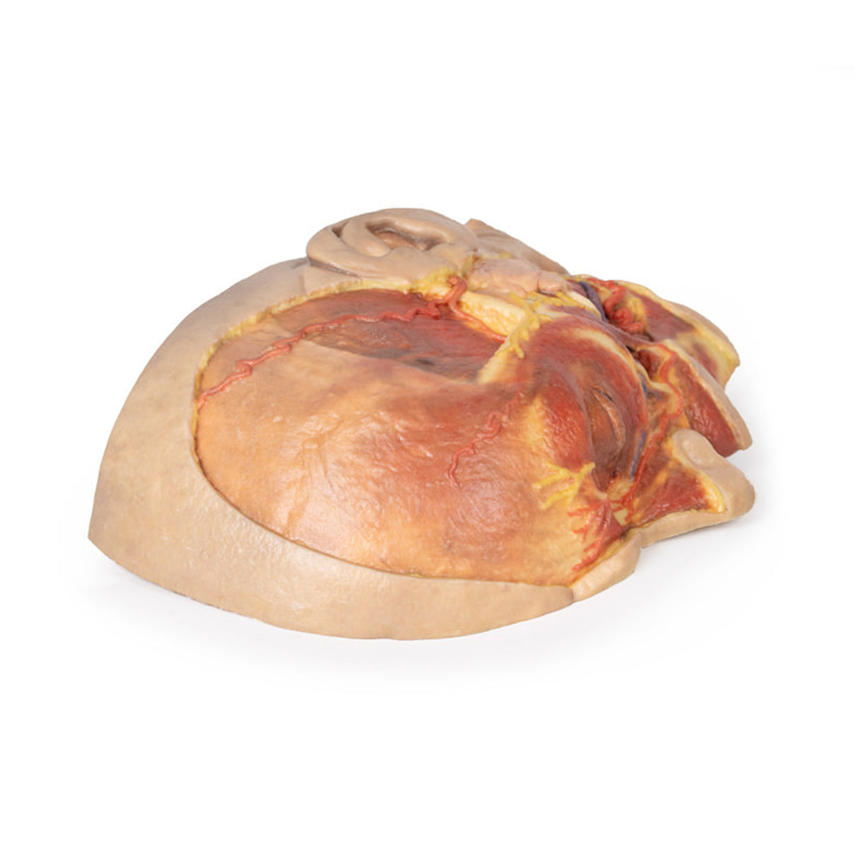 Superficial Face | EZ-MP1108 | Sim & Skills Ltd