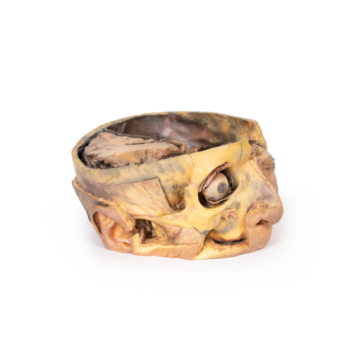 Transverse Section of the head |x EZ-MP1110 | Sim & Skills Ltd