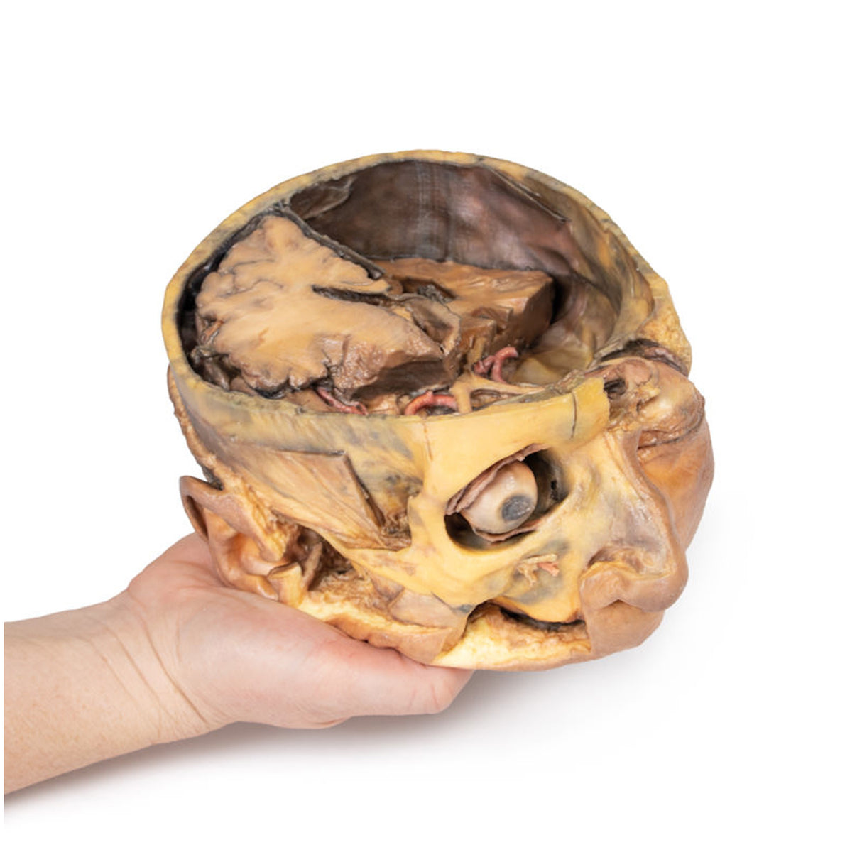 Transverse Section of the head