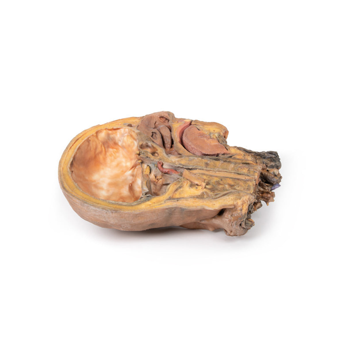 Sagittal Section of Head and Neck with Infratemporal Fossa and Carotid Sheath Dissection | EZ-MP1111 | Sim & Skills Ltd