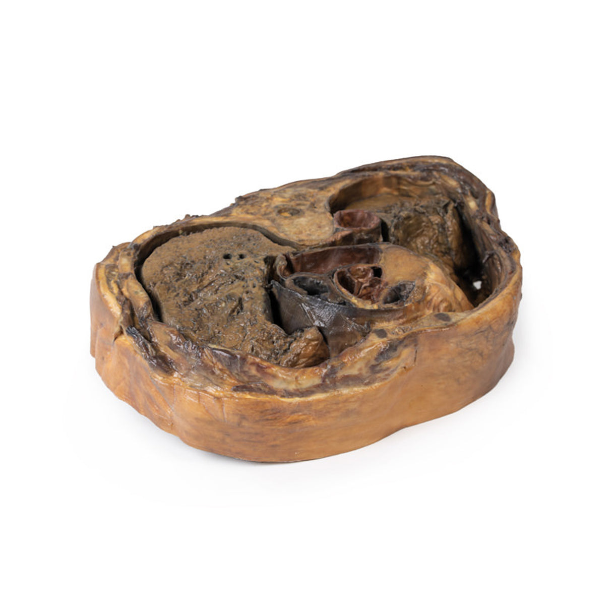 Thoracic cross section at T6 | EZ-MP1120 | Sim & Skills Ltd