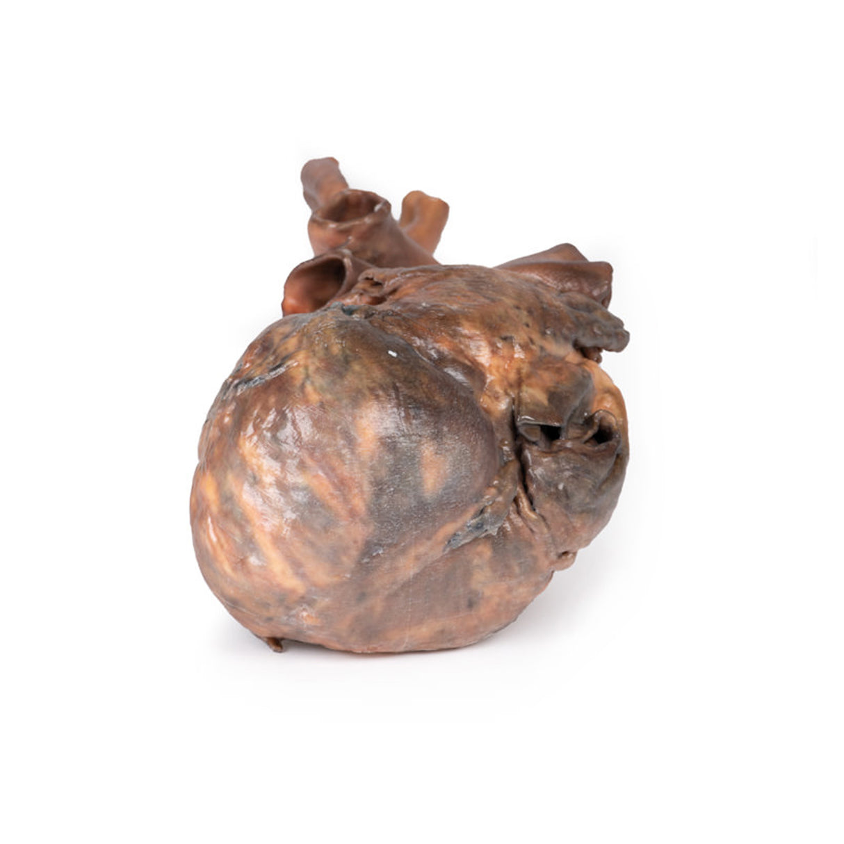 Heart | EZ-MP1123 | Sim & Skills Ltd