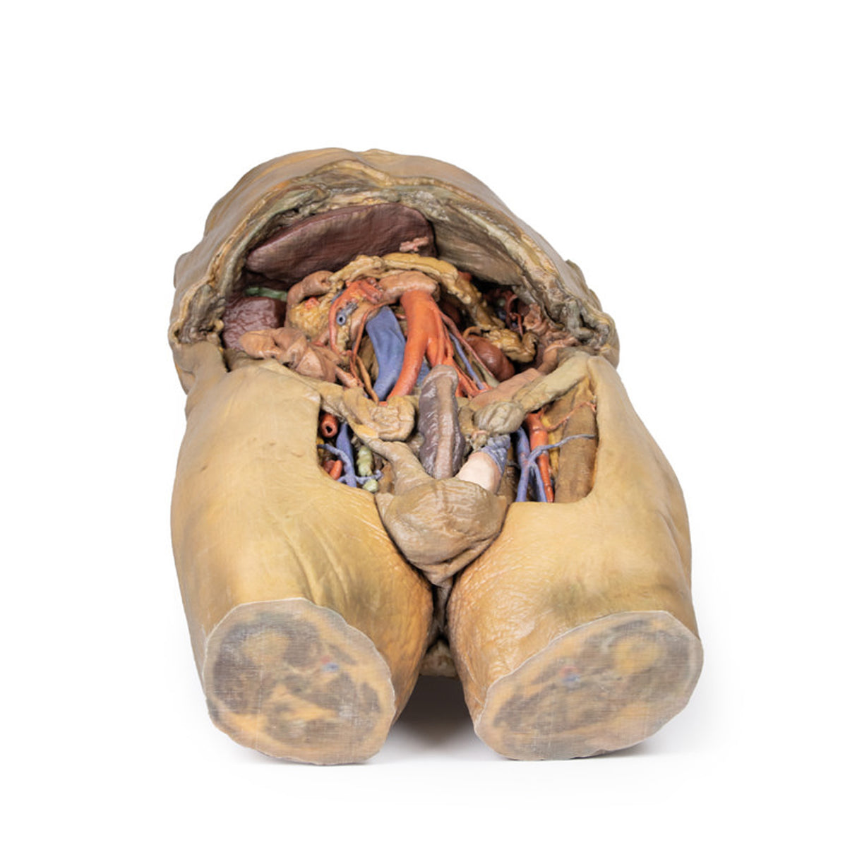 Abdomen with bilateral Hernias | EZ-MP1130 | Sim & Skills Ltd