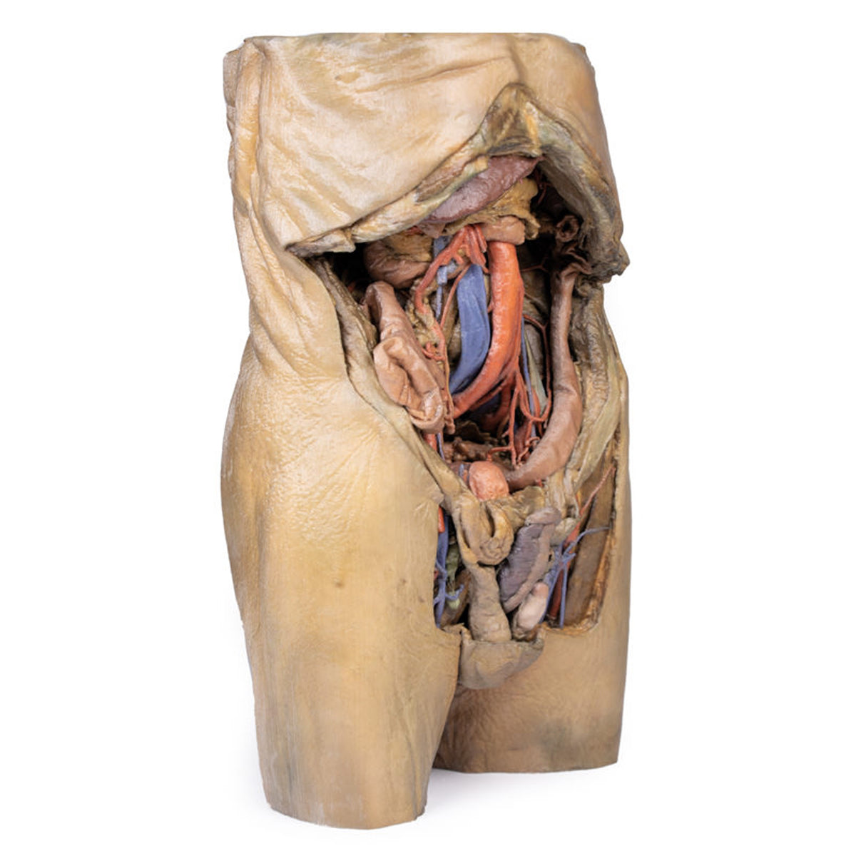 Abdomen with bilateral Hernias | EZ-MP1130 | Sim & Skills Ltd