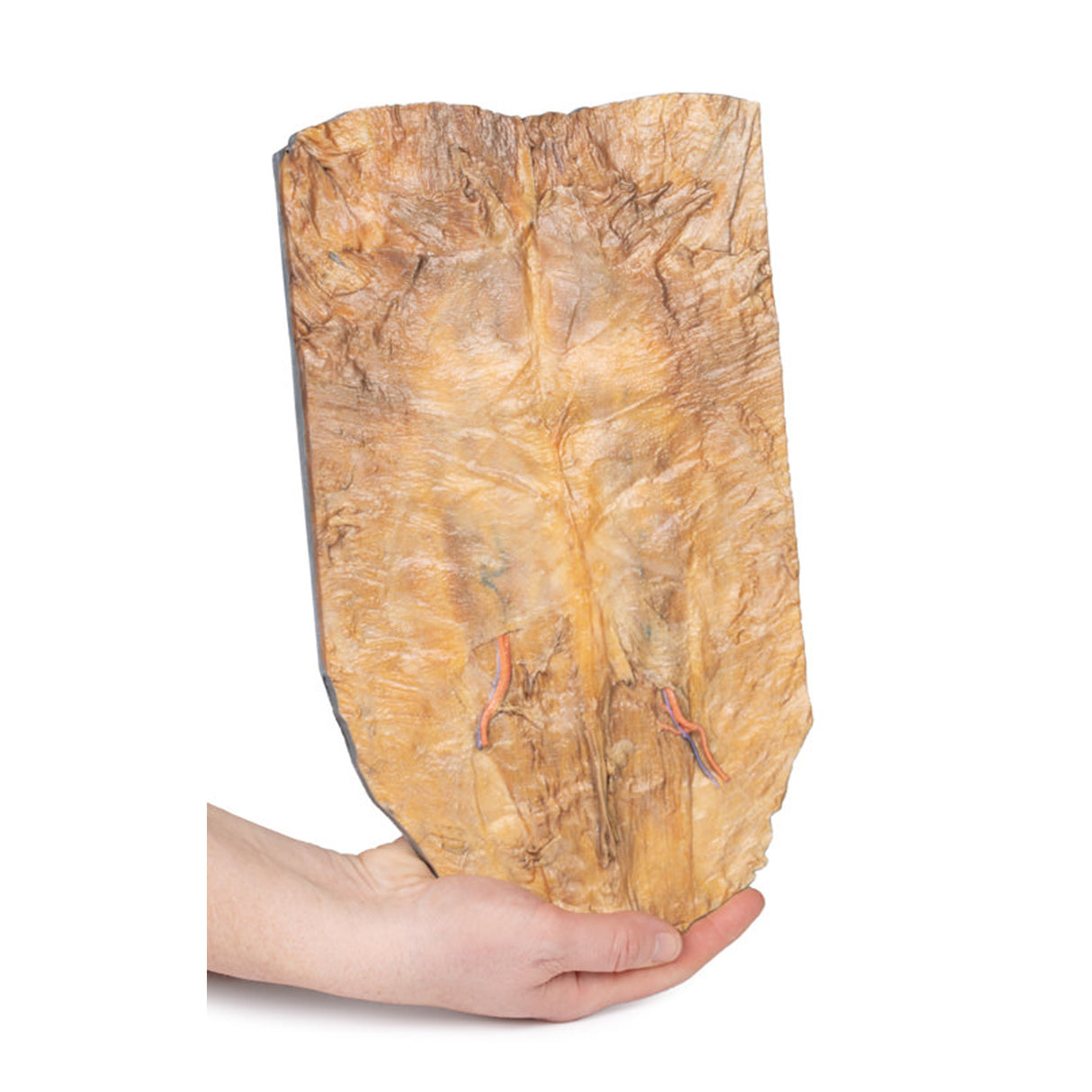 Internal abdominal wall | EZ-MP1137 | Sim & Skills Ltd