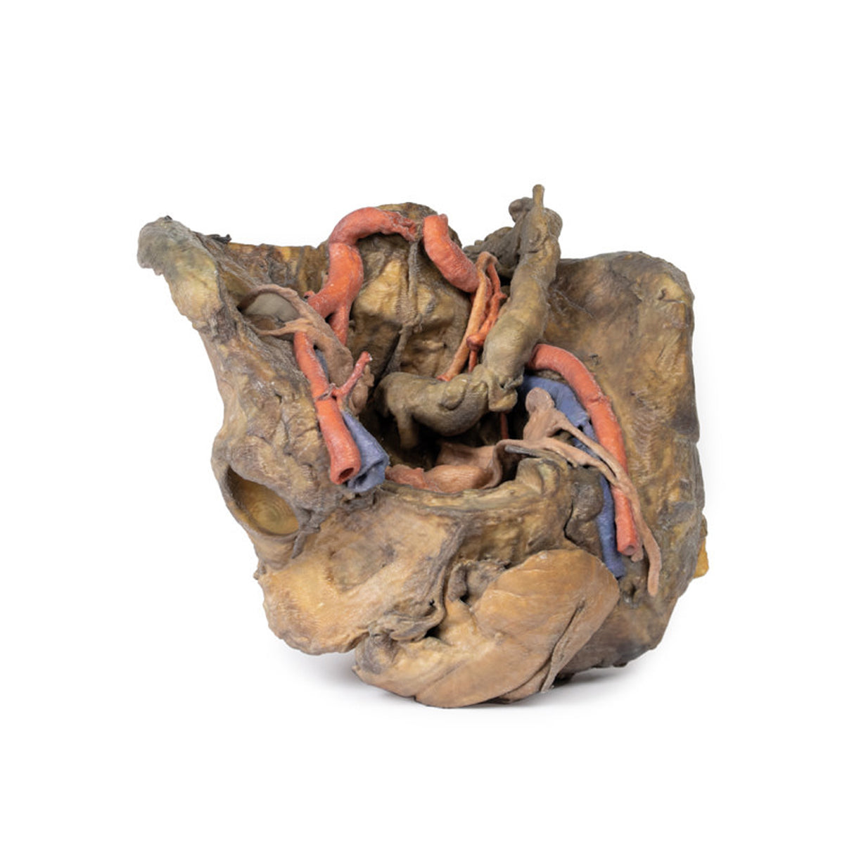 Female pelvis deep dissection | EZ-MP1141 | Sim & Skills Ltd