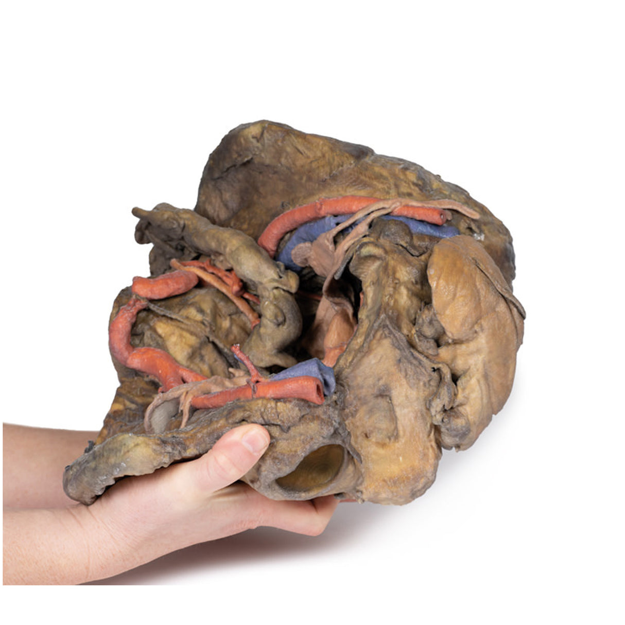 Female pelvis deep dissection | EZ-MP1141 | Sim & Skills Ltd