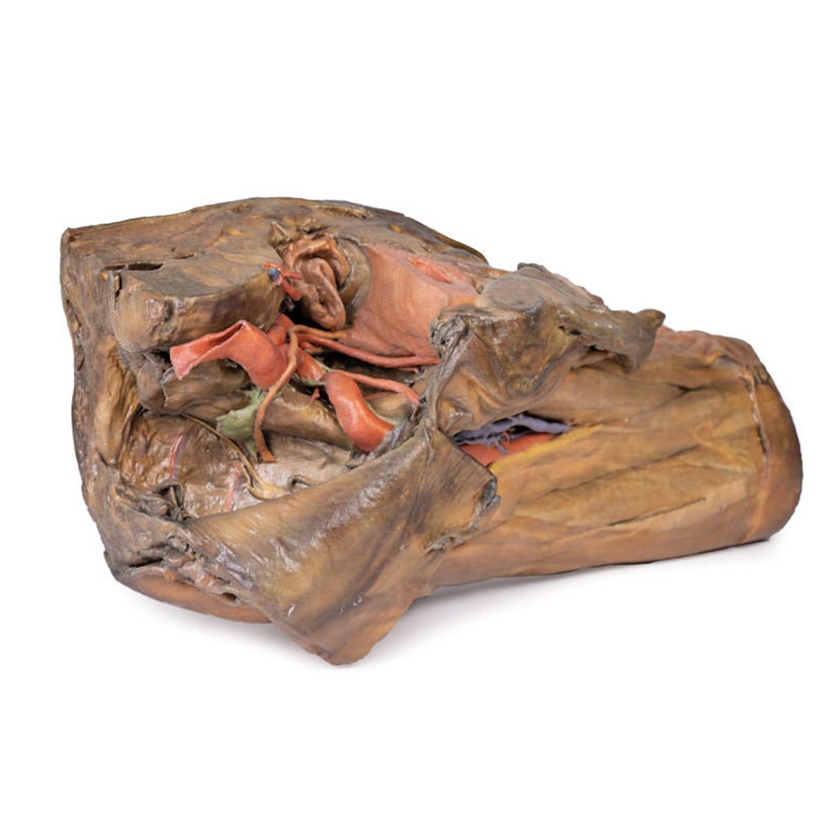 Male hemipelvis and thigh | EZ-MP1142 | Sim & Skills Ltd