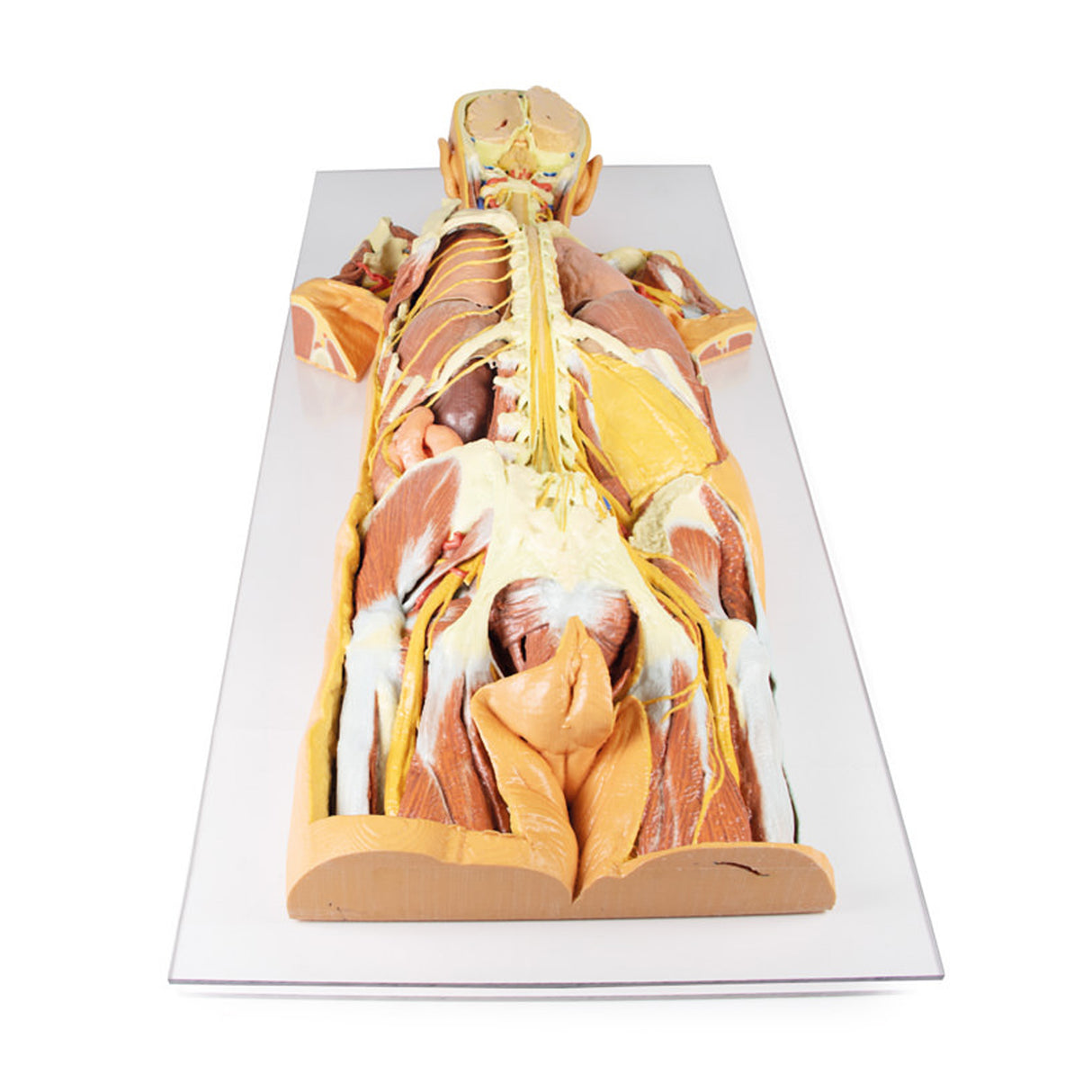 Nervous System Dissection (posterior view) | EZ-MP1400 | Sim & Skills Ltd