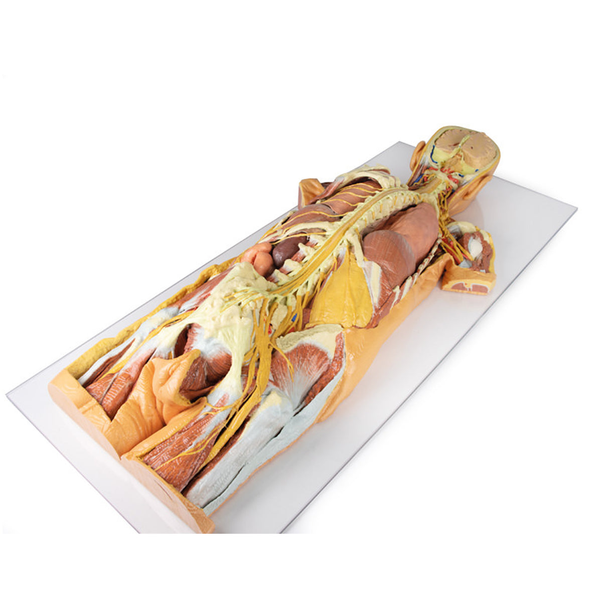 Nervous System Dissection (posterior view) | EZ-MP1400 | Sim & Skills Ltd