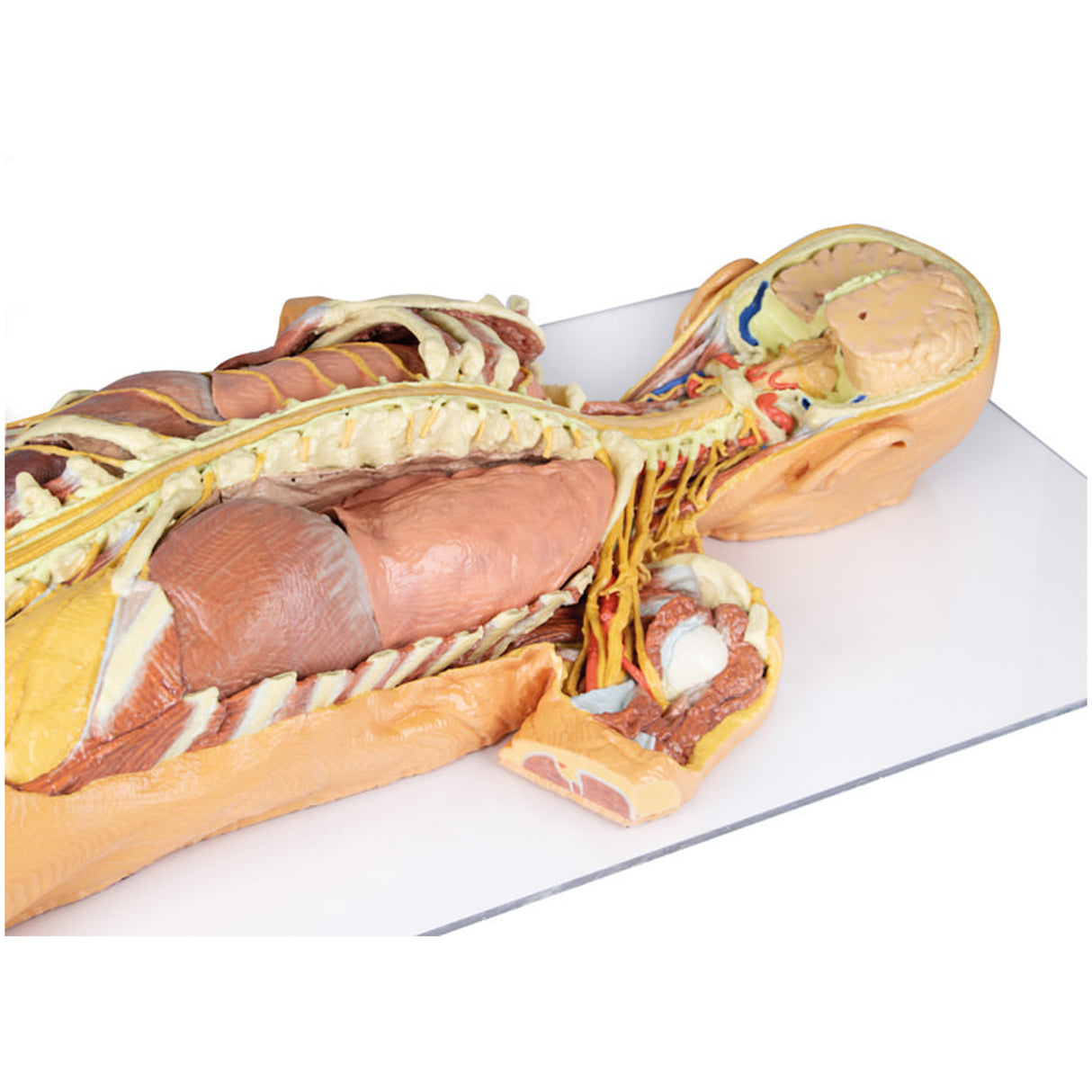 Nervous System Dissection (posterior view) | EZ-MP1400 | Sim & Skills Ltd
