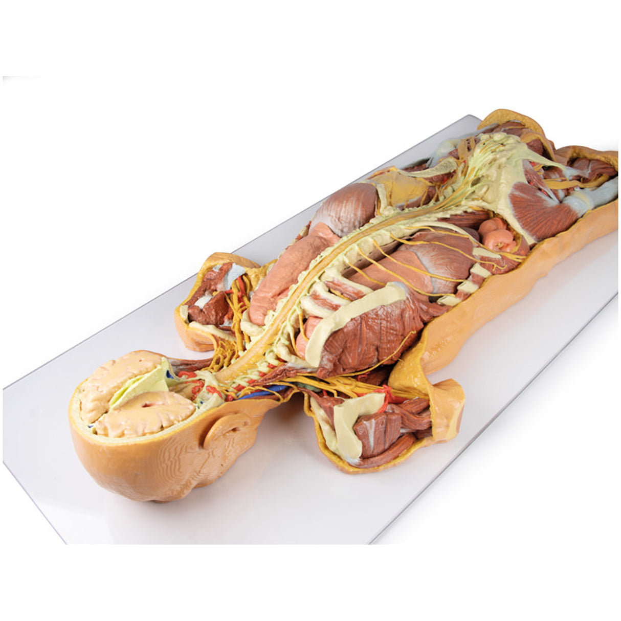 Nervous System Dissection (posterior view) | EZ-MP1400 | Sim & Skills Ltd