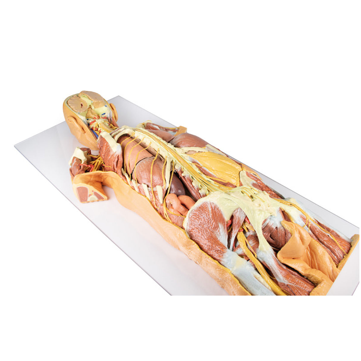 Nervous System Dissection (posterior view) | EZ-MP1400 | Sim & Skills Ltd