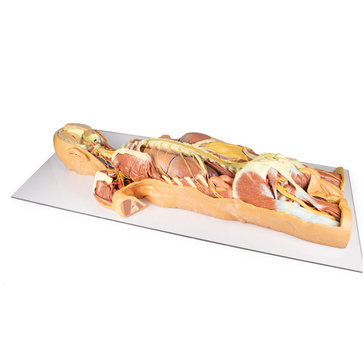 Nervous System Dissection (posterior view) | EZ-MP1400 | Sim & Skills Ltd