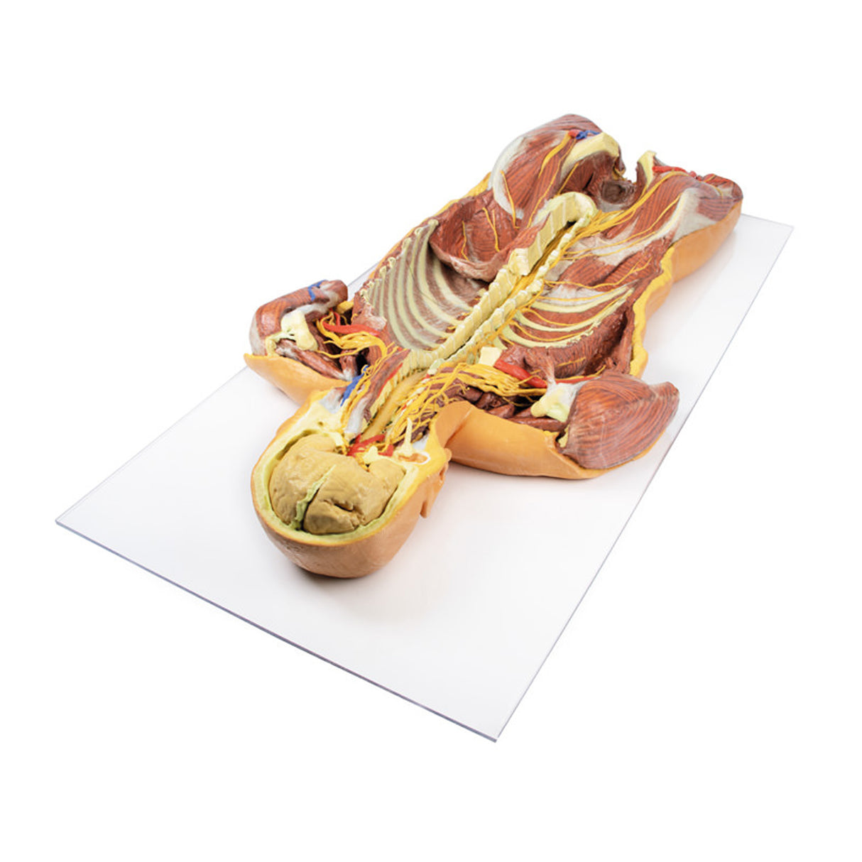Posterior Body Wall / Ventral Deep Dissection | EZ-MP1410 | Sim & Skills Ltd