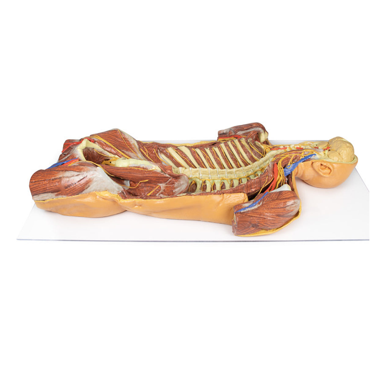Posterior Body Wall / Ventral Deep Dissection | EZ-MP1410 | Sim & Skills Ltd