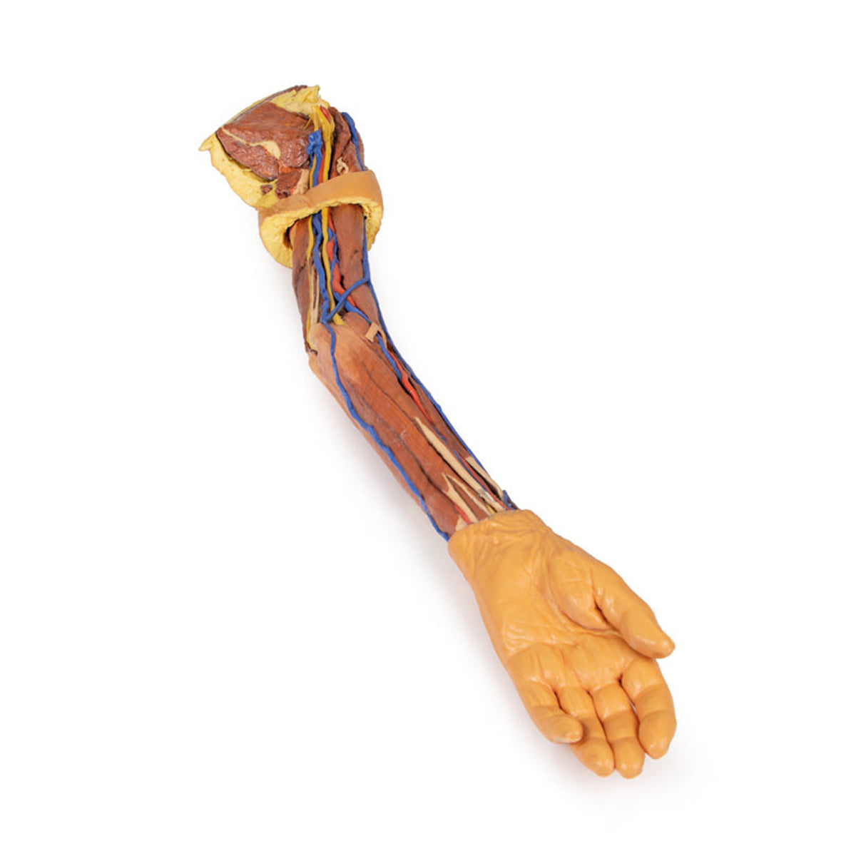 Upper Limb | EZ-MP1500 | Sim & Skills Ltd