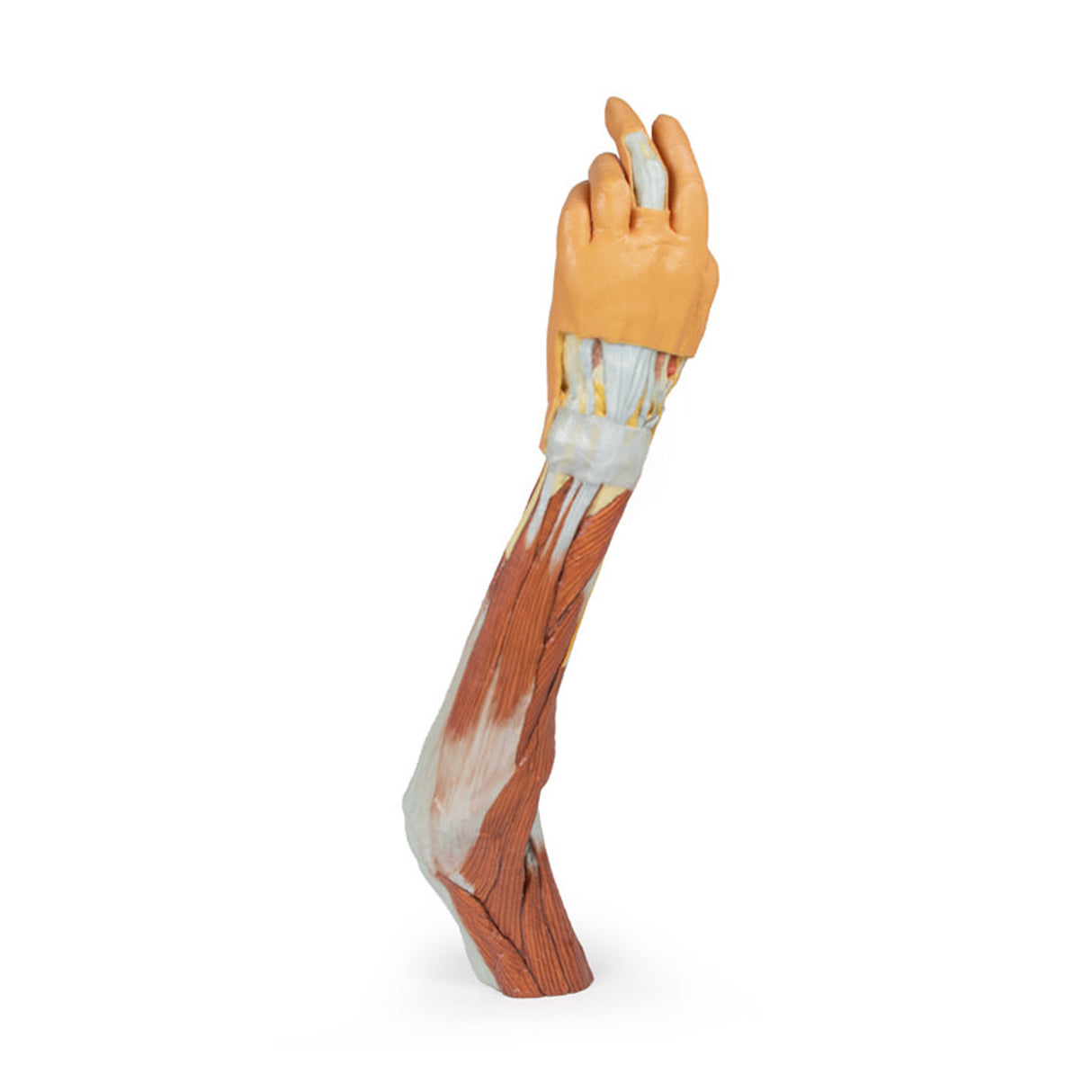 Upper Limb - elbow, forearm and hand | EZ-MP1510 | Sim & Skills Ltd