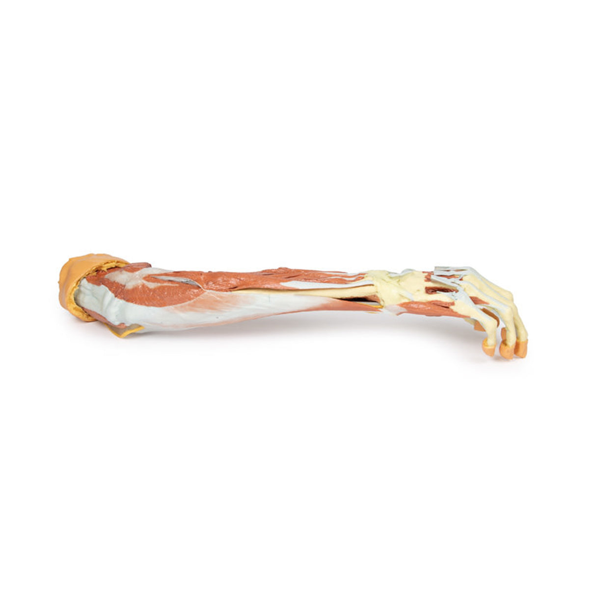 Deep upper limb and hand | EZ-MP1513 | Sim & Skills Ltd