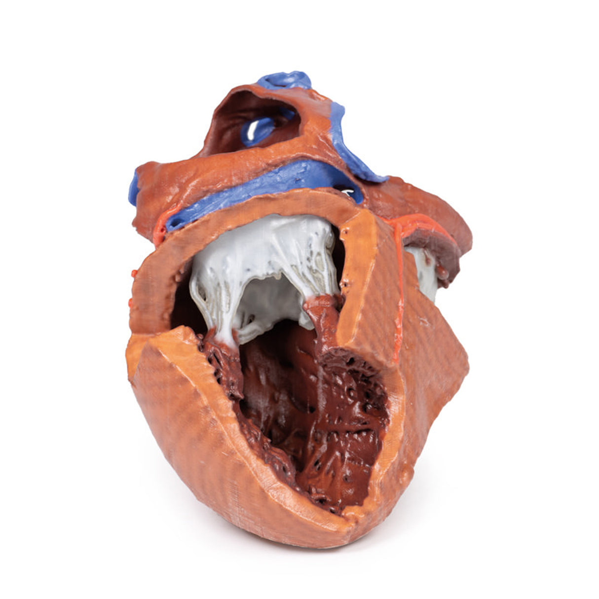 Heart internal structures | EZ-MP1715 | Sim & Skills Ltd