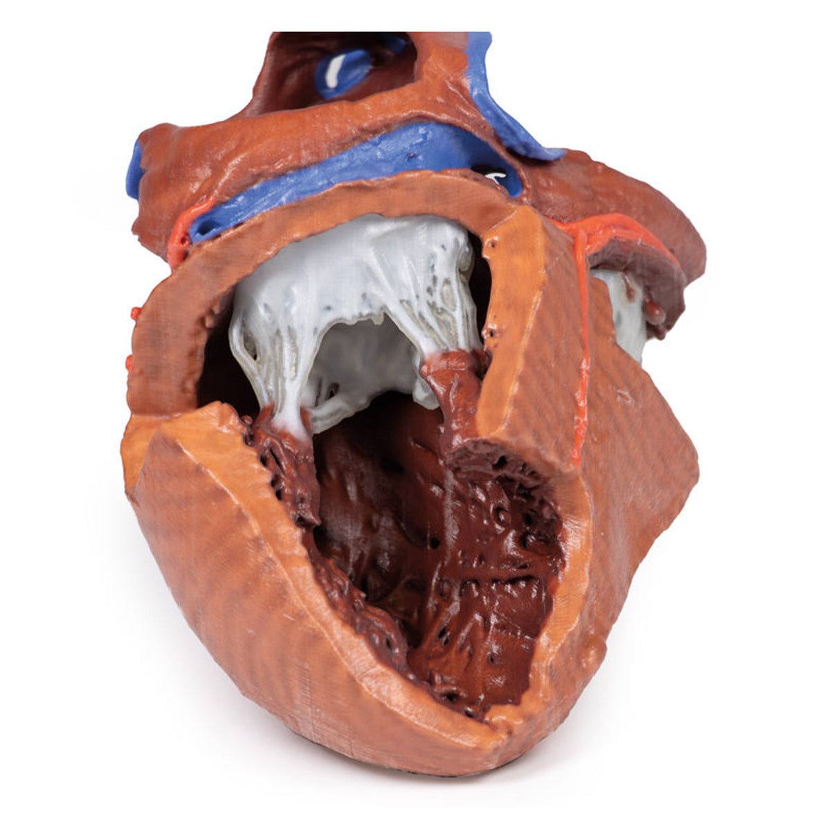 Heart internal structures | EZ-MP1715 | Sim & Skills Ltd