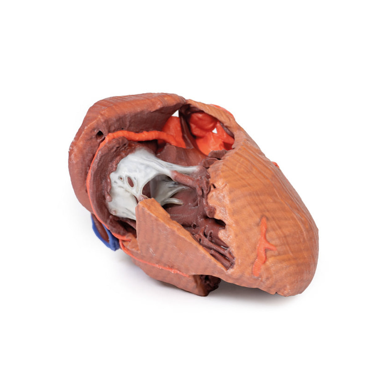 Heart internal structures | EZ-MP1715 | Sim & Skills Ltd