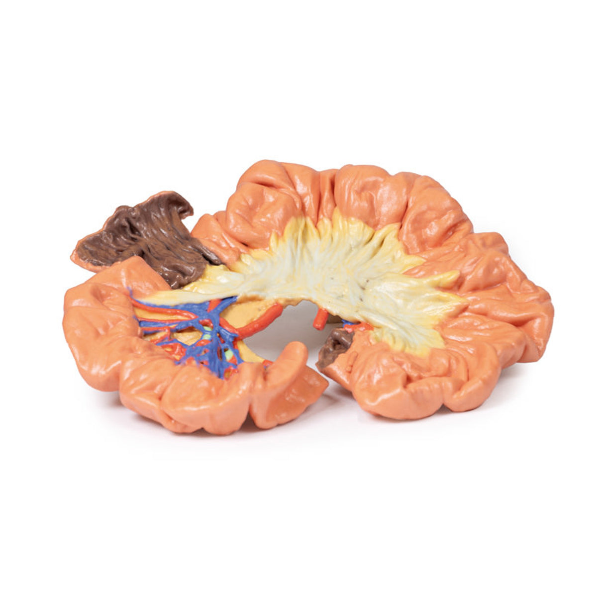 Bowel - Portion of Ileum | EZ-MP1725 | Sim & Skills Ltd