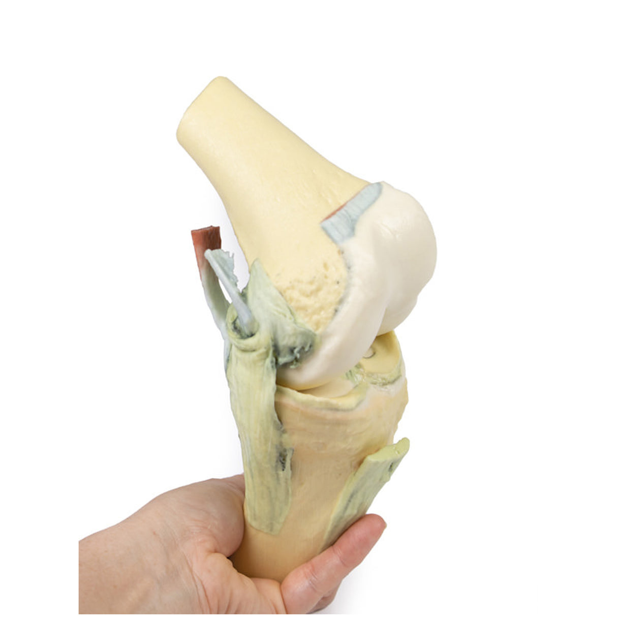 Knee Joint, flexed | EZ- MP1800 | Sim & Skills Ltd