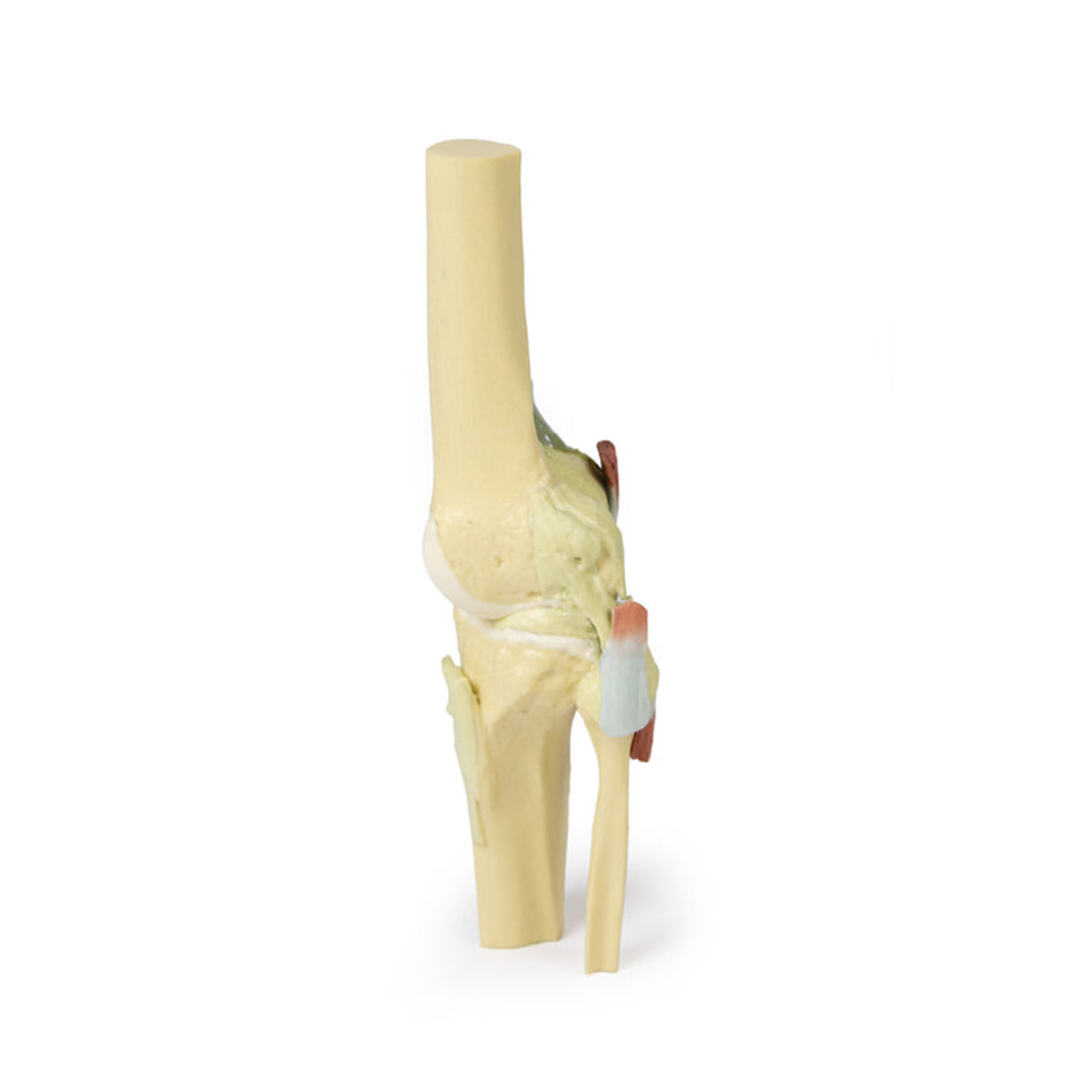 Knee Joint, extended | EZ-MP1805 | Sim & Skills Ltd
