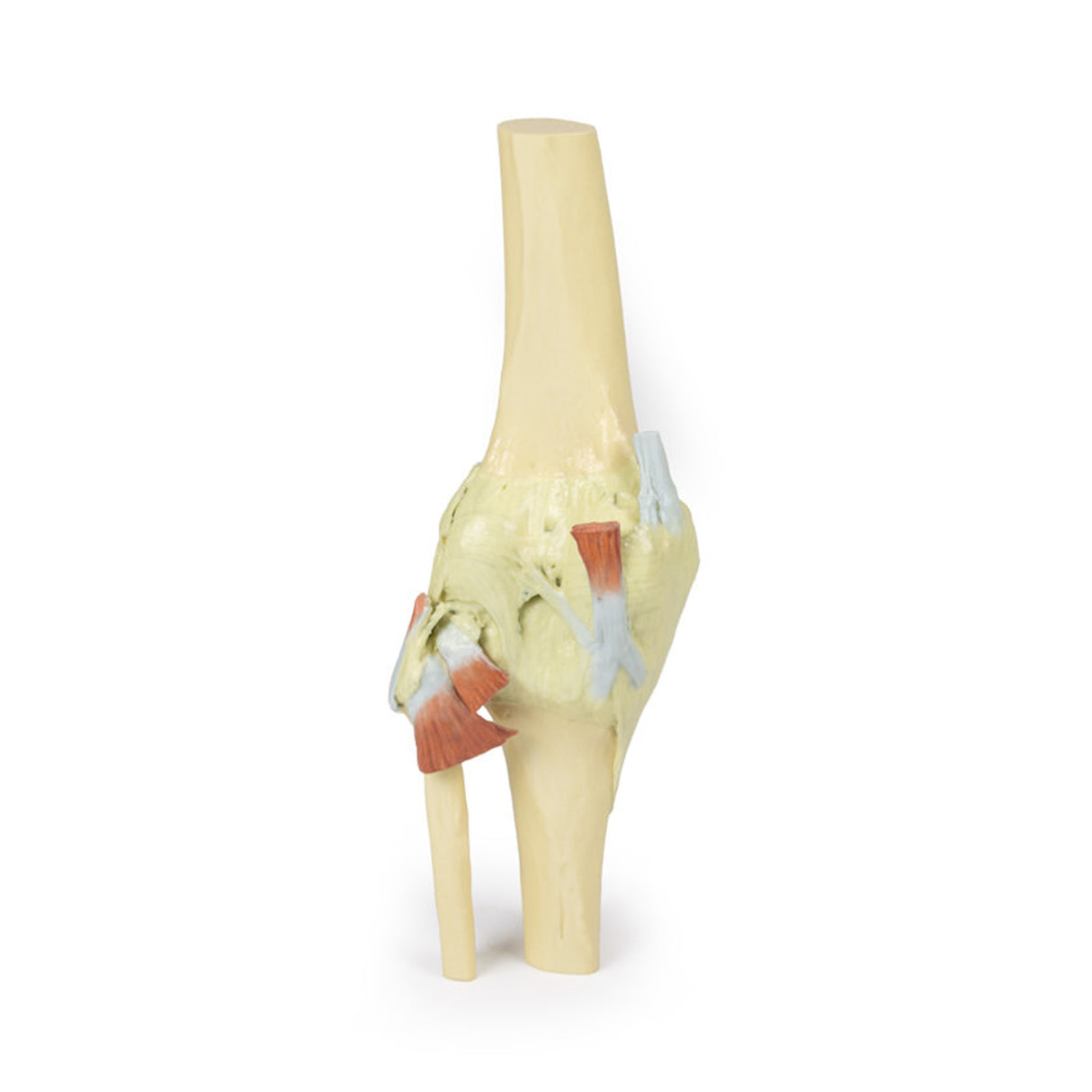 Knee Joint, extended | EZ-MP1805 | Sim & Skills Ltd