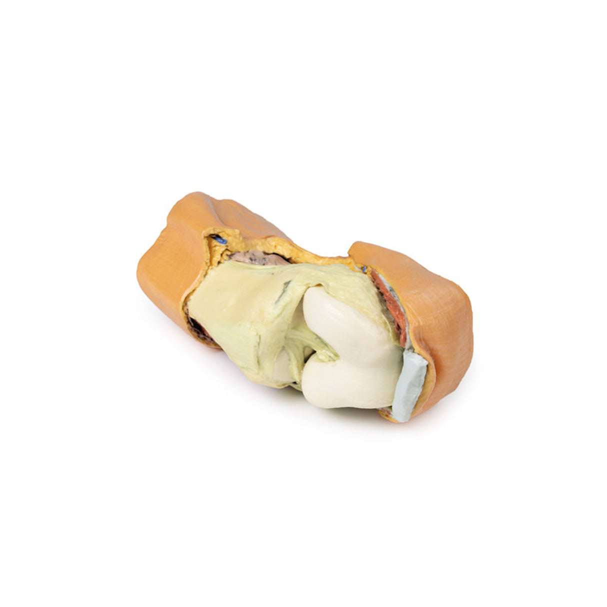 Flexed knee joint deep dissection | EZ-MP1807 | SIm & Skills Ltd