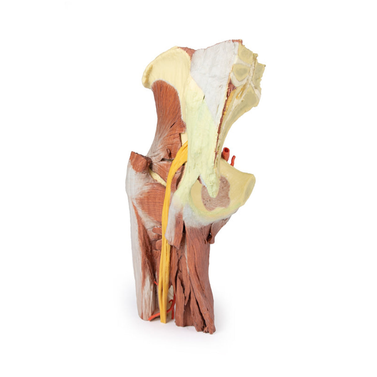 Lower Limb - deep dissection of a left pelvis and thigh | EZ-MP1813 | Sim & Skills Ltd