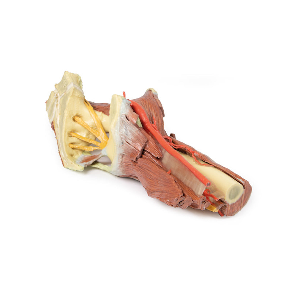 Lower Limb - deep dissection of a left pelvis and thigh | EZ-MP1813 | Sim & Skills Ltd