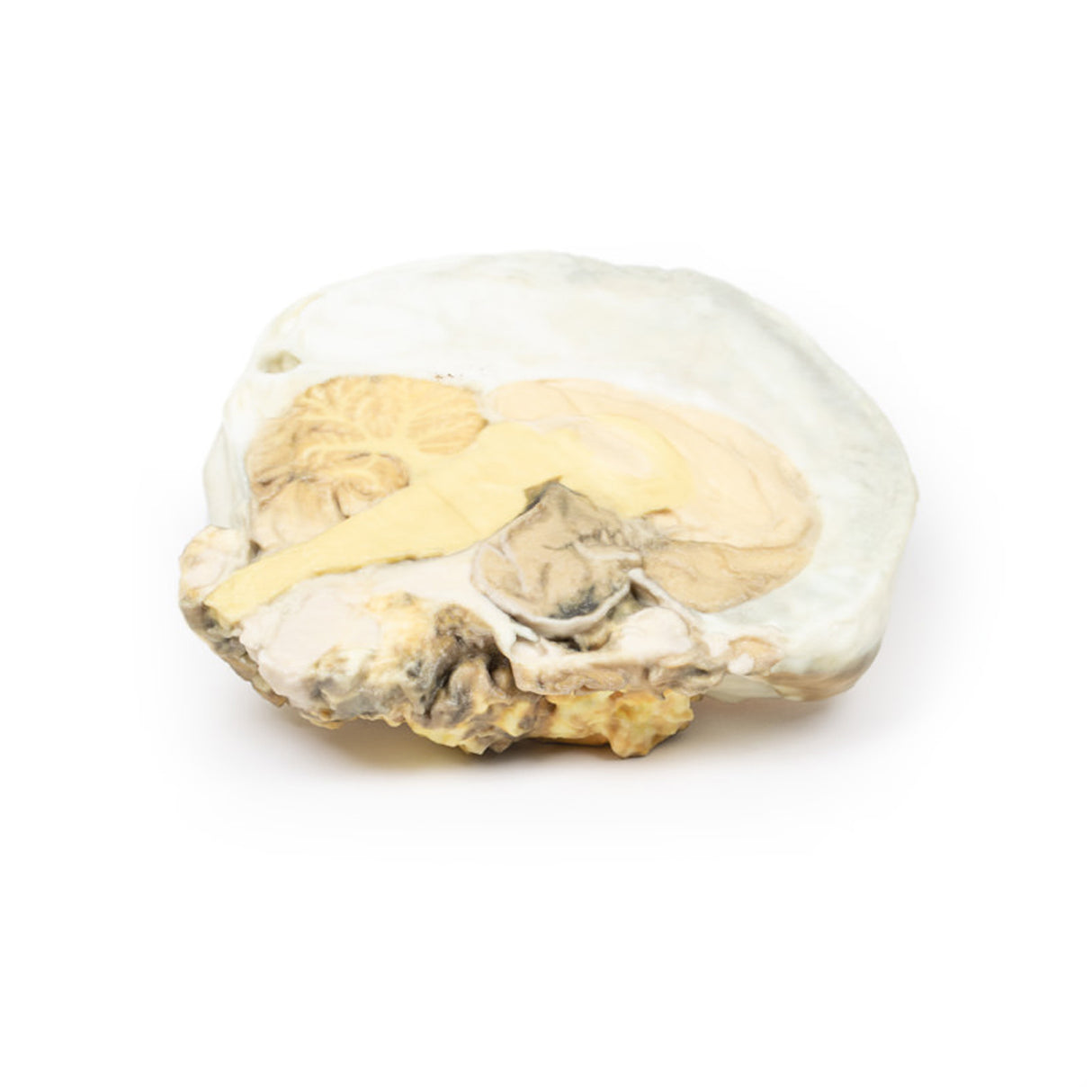 Pituitary Adenoma | EZ-MP2006 | Sim & Skills Ltd