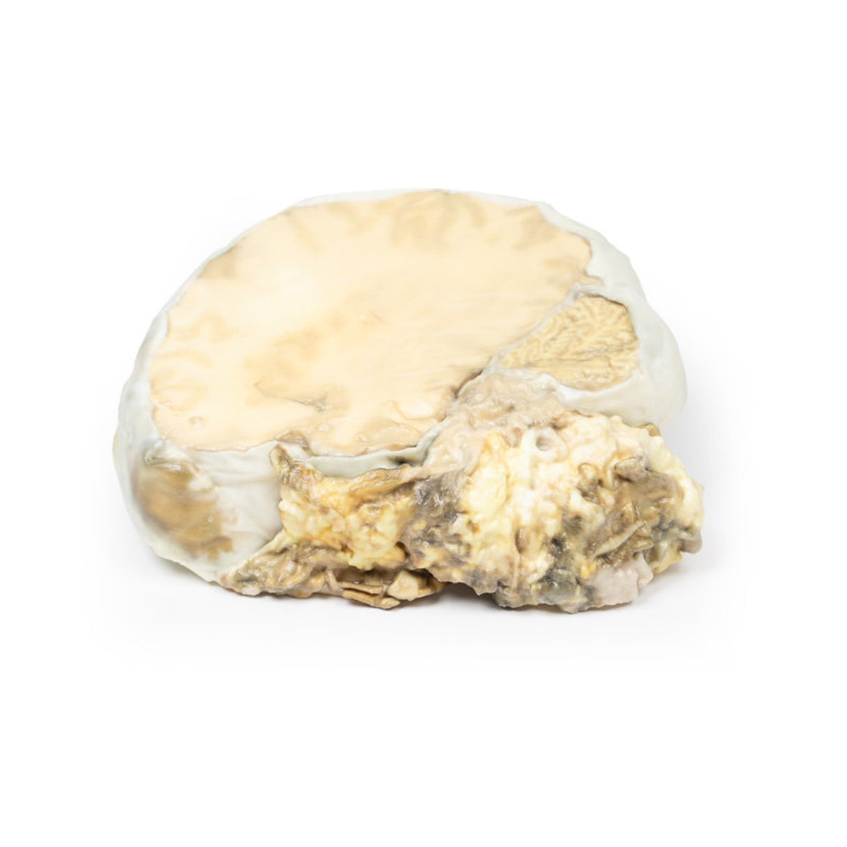 Pituitary Adenoma | EZ-MP2006 | Sim & Skills Ltd