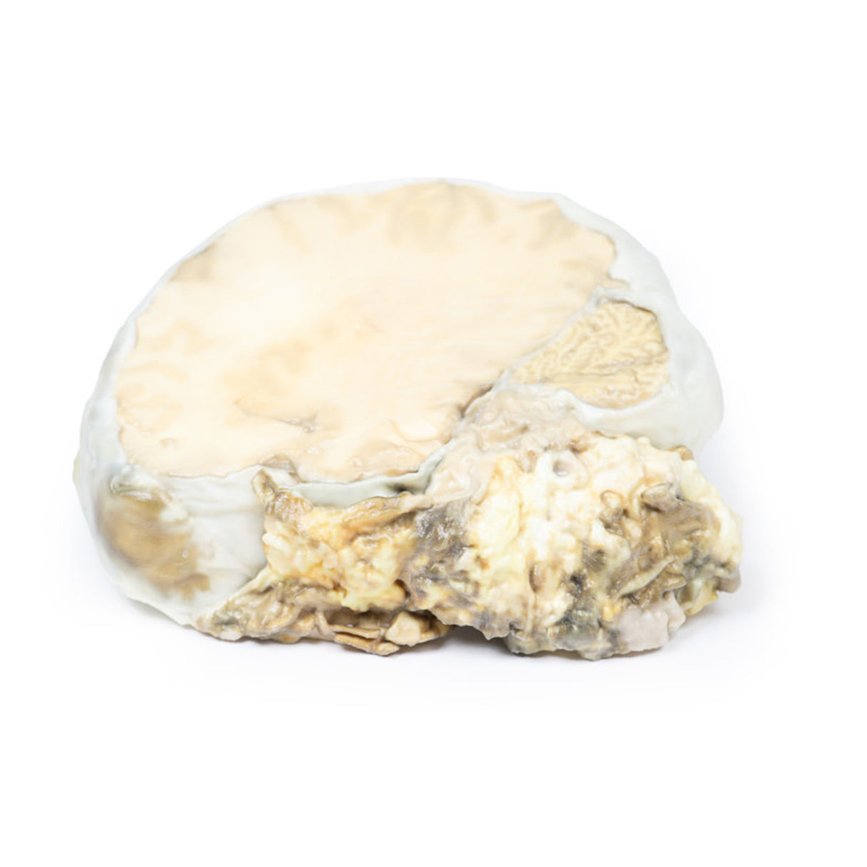 Pituitary Adenoma | EZ-MP2006 | Sim & Skills Ltd